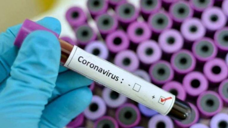 SBV confirma nova linhagem do coronavírus no interior paulista
